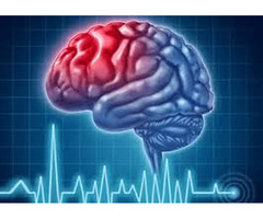 Top Neuro Hospital in Patna: A Comprehensive Guide to the Best Neurological Care