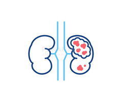 Best Kidney Cancer Treatment Hospitals in Hyderabad