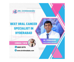 Best Oral Cancer Specialist in Hyderabad