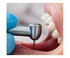 Steps to Find Quality Dental Care in Panchkula