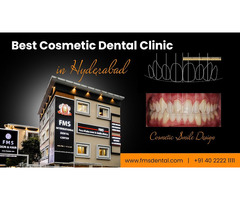 Best Cosmetic Dental Clinic In Hyderabad