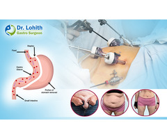 Best Bariatric & Weight Loss Surgery in Bangalore - Dr. Lohith U