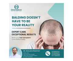 Get Natural-Looking Hair Transplant in Delhi at Desmoderm