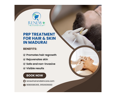 prp treatment in madurai - Renew Hair and Skin Care