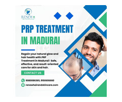 PRP Treatment in Madurai – Hair & Skin Rejuvenation | Renew Hair & Skincare